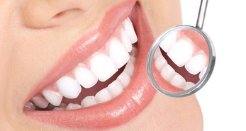 Dental Consults and Check-ups and how they prevent dental problems