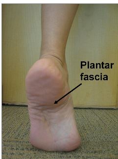 Pain in the heel of your foot can be traced back to Plantar Fasciitis