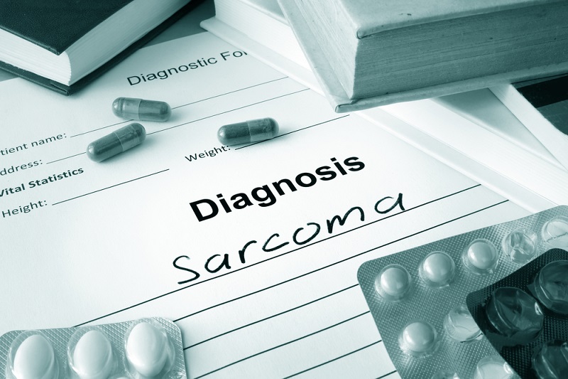 Sarcoma Cancer: Symptoms, Causes And Treatment