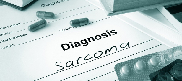 Adenocarcinoma Cancers: Symptoms, Causes, Diagnosis & Treatment