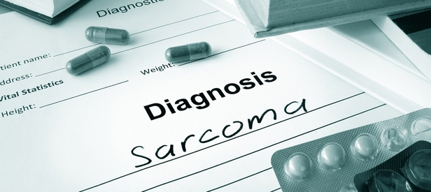 Soft Tissue Sarcoma Symptoms, Risk Factors, and Diagnosis