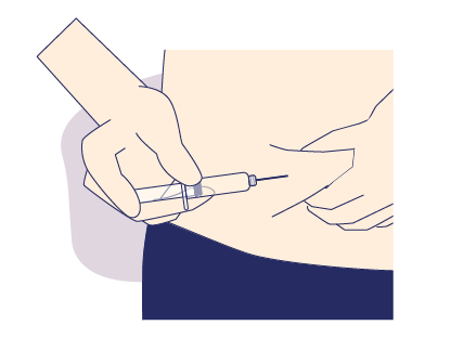 Prefilled Syringe Admin Sit 4.1.jpg