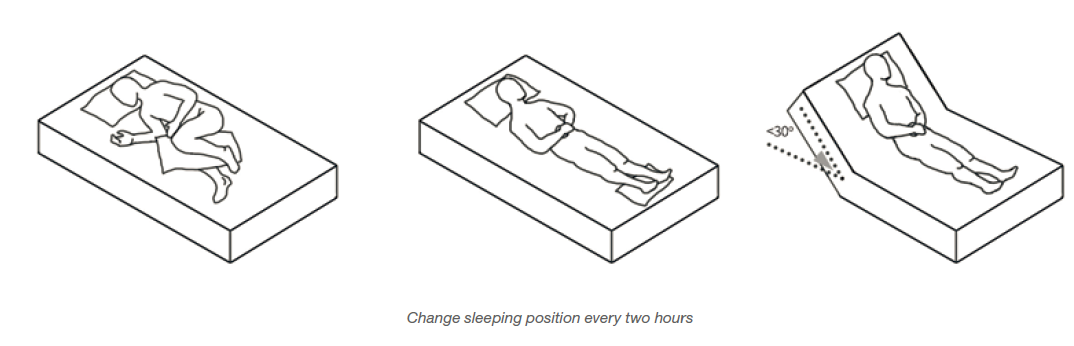 Changing the sleeping position every two hours can prevent pressure sores.