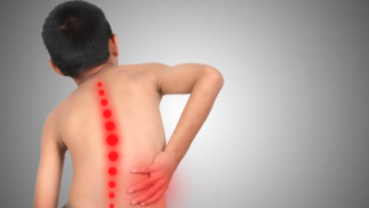 Scoliosis affects children of all races