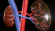 Chronic Kidney Disease