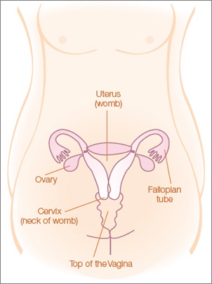 Diagram of Cervical Cancer