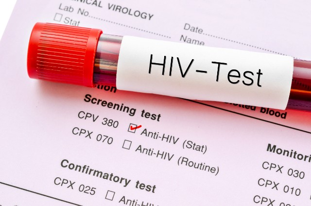 hiv screening