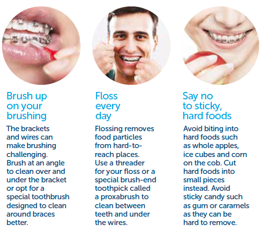 Maintain your oral hygiene by brushing, flossing and avoiding sweets that can stick to your braces.
