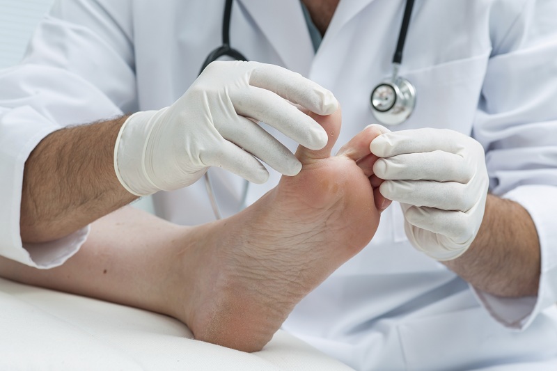 Athlete's Foot or Tinea Pedis - Best Diabetes Hospital in Kerala