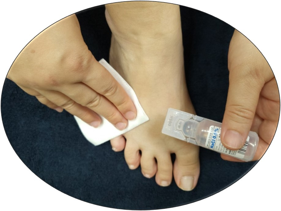 clean wound with saline.jpg