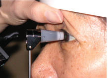 An eye specialist can monitor the progression of glaucoma.