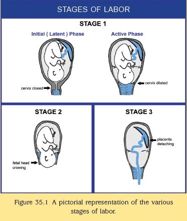 Stages of labor and delivery