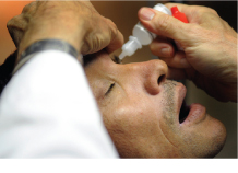 Intravenous or oral anti-glaucoma medications are given to relieve high eye pressure. 