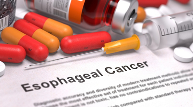 esophagealcancer.jpg