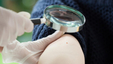 Moles are common. How do you know if a growth is melanoma?