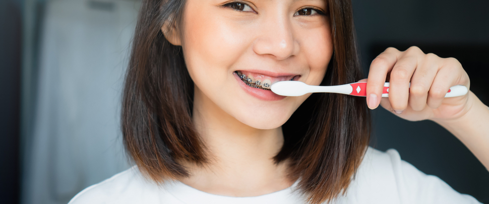 How to Care for Your Teeth When You Have Braces