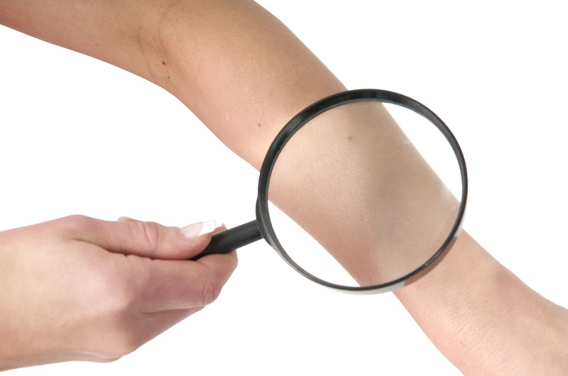 skin_magnified.jpg