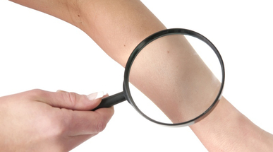 skin_magnified.jpg