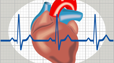 heartarrhythmia.jpg