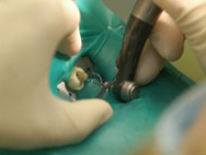 During dental treatments, dentists wear protective clothing to reduce the risk of transmission