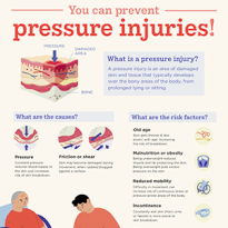 You can prevent pressure injuries