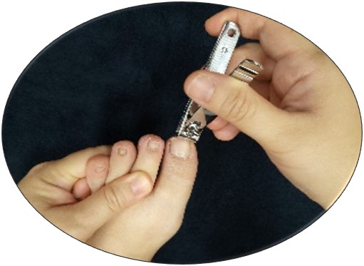 Trim your toenails in a straight line across.jpg