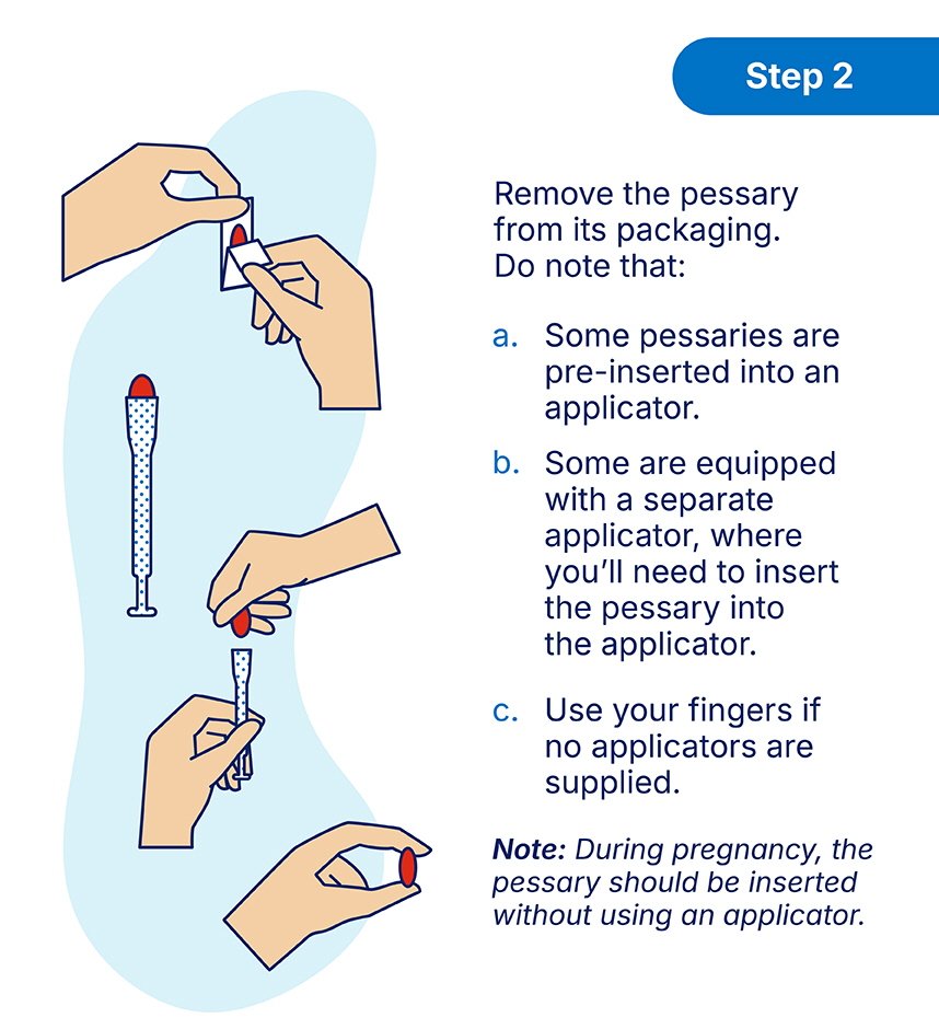 Vaginal Pessary_Output_How to VP Step 2.jpg