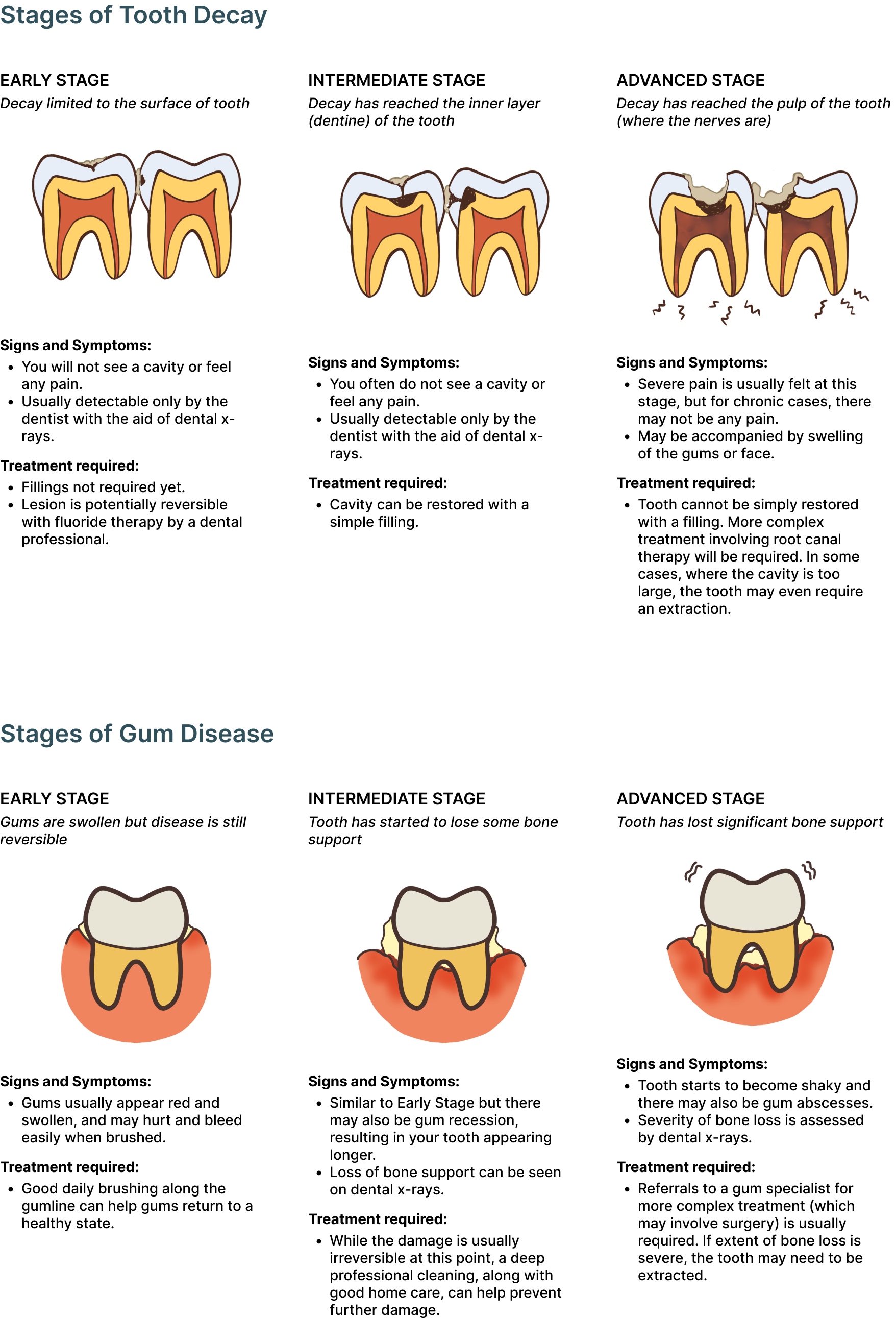 Caries Progression