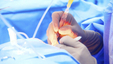 Laser Technologies—Surgical Techniques