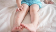A young child on the bed with mosquito bites all over her legs