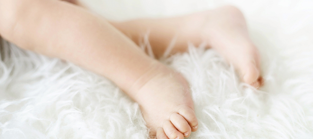 What Is Clubfoot? - Symptoms and Treatment