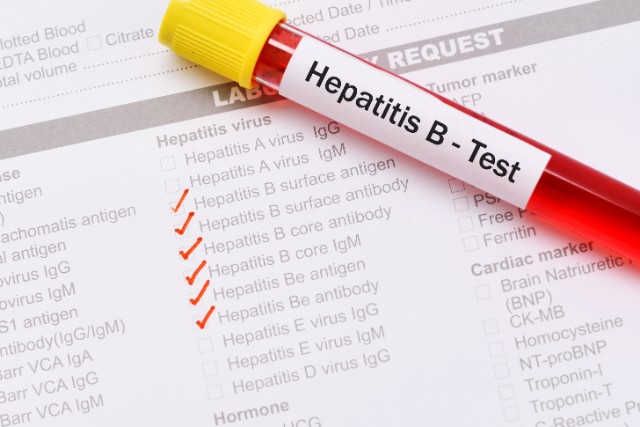 hepatitis b screening