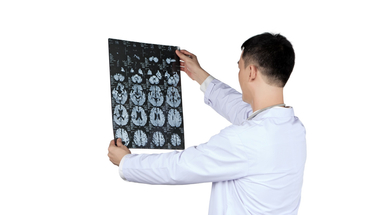 National Neuroscience Institute - Acoustic_neuroma_2.jpg