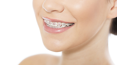 iStock-dental braces.jpg