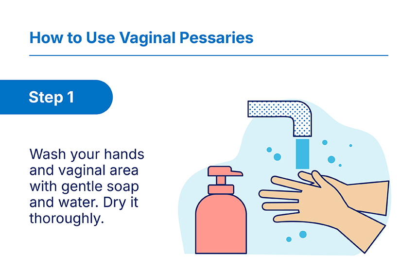 Vaginal Pessary_Output_How to VP Step 1.jpg