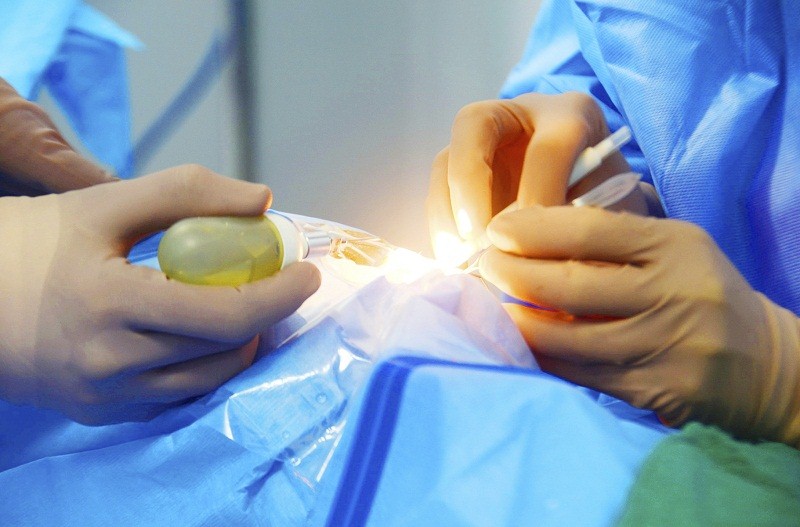 lasik_eye_operation.jpg