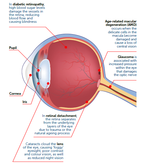 Regular eye checks help to monitor your eye health.