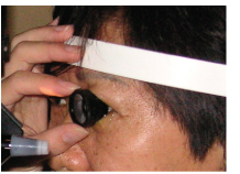 A medical professional will employ several methods to diagnose glaucoma.