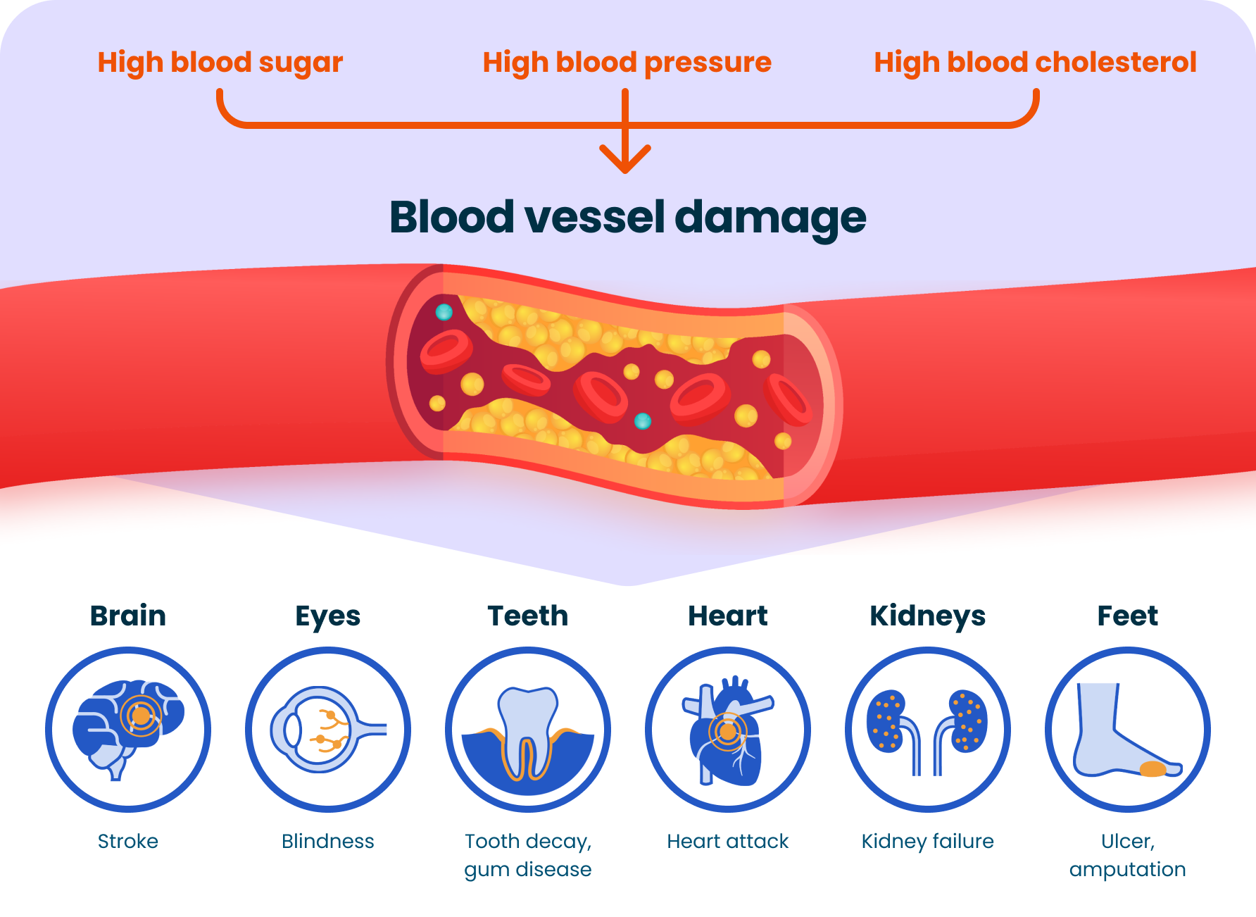 High blood sugar, high blood pressure and high blood cholesterol will damage blood vessels.