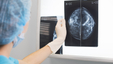 mammogram-results-xray