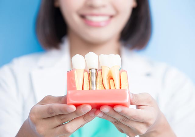 Improve oral hygiene with dental implants