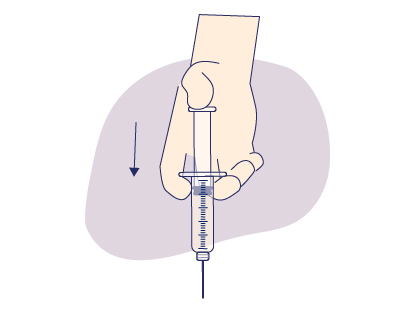 Prefilled Syringe Prep 5.jpg